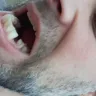 Secure Dental Davenport IA - Dental services