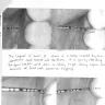 Dental Works - Dental bridge - Photo 1