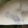 American Red Cross - Attempted blood donation challenges - Photo 1