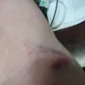 American Red Cross - Blood Drawing - Photo 2