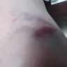 American Red Cross - Blood Drawing - Photo 1
