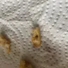 A&W Restaurants - Got big black stone like thing in my fries bought from a and w at country hills stone calgary - Photo 1