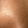 Kampgrounds Of America [KOA] - Bed bugs - Photo 1