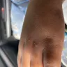 Kampgrounds Of America [KOA] - Bed bugs - Photo 5