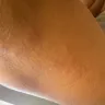 Kampgrounds Of America [KOA] - Bed bugs - Photo 4