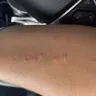 Kampgrounds Of America [KOA] - Bed bugs - Photo 11