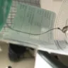 Mirena IUD - Miserable iud - Photo 4