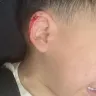 Old Navy - My son sliced his ear