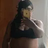 Ideal Image - Coolsculpting - Photo 2