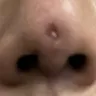 Vogue Clinic - Nose thread - Photo 1