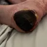 KRMC Home Healthcare - Wound care, shower services and physical therapy - Photo 3