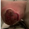 KRMC Home Healthcare - Wound care, shower services and physical therapy - Photo 2