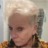 Ideal Image - Did not do procedures right. Totally scammed - Photo 2