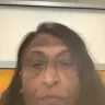 UCLA Health - Dermotology - correction of my skin condition - Photo 1