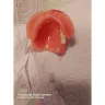 Aspen Dental - Dentures - Photo 1