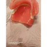 Aspen Dental - Dentures - Photo 2