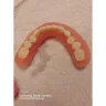 Aspen Dental - Dentures - Photo 6