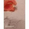 Aspen Dental - Dentures - Photo 3