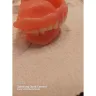 Aspen Dental - Dentures - Photo 5