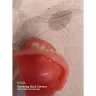 Aspen Dental - Dentures