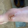 Carnival Cruise Lines - Medical injury on mardi gras ship 3/29/22 suite 9415 - Photo 1