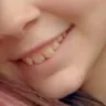 Comfort Dental - Dentist attempted to fill gaps of my teeth without my knowledge or permission - Photo 1