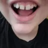 Comfort Dental - Dentist attempted to fill gaps of my teeth without my knowledge or permission - Photo 2