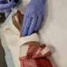 Mercy Medical Center - Cortisone shot/wrists treatment - Photo 3