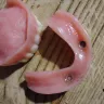 Aspen Dental - Upper denture and lower implants - Photo 2