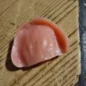 Aspen Dental - Upper denture and lower implants - Photo 1