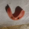 Aspen Dental - Upper denture and lower implants - Photo 4