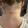 Supercuts - My neck was injured during a routine trim.