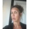 IPL LASER performed by Dr Susan Rabizadeh at Cedars Sinai - Laser Ipl - Photo 2