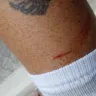 Wawa - Being cut by broken Glass in Wawa parking lot - Photo 3