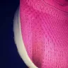 Skechers USA - Damaged sneakers