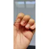 Nail Palace - Damaged nails from treatment