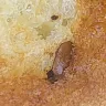 Denny's - Pancakes. I found some kind of larvae in my pancakes.