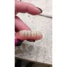 Aspen Dental - Dentures - Photo 3