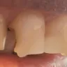 Aspen Dental - Service - Photo 1