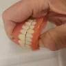 Aspen Dental - Dentures - Photo 2