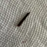 WakeMed Health & Hospitals - Splinter on my son hand. - Photo 1