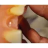 Aspen Dental - Denture repair - Photo 1
