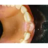 Aspen Dental - Denture repair - Photo 2