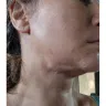 Mayclinik - Deep plane facelift, neck lift, eye and brow lift - Photo 1