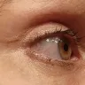 Mayclinik - Deep plane facelift, neck lift, eye and brow lift - Photo 2