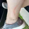 Aldi - Injury - Photo 1