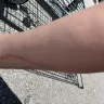 Aldi - Injury - Photo 4