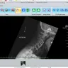 Nexxt Spine - Spinal fusion surgery hardware - Photo 2
