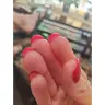 Sorbet Group - Very poor nails - Photo 4
