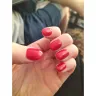 Sorbet Group - Very poor nails - Photo 1